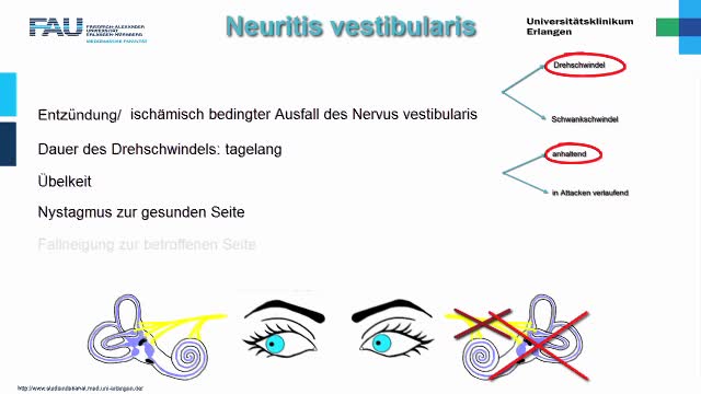 Medcast - Neurologie - Schwindel 2 preview image