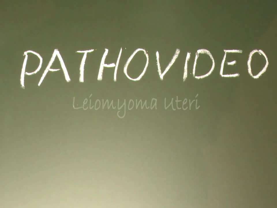 Pathovideo - Leiomyoma uteri preview image