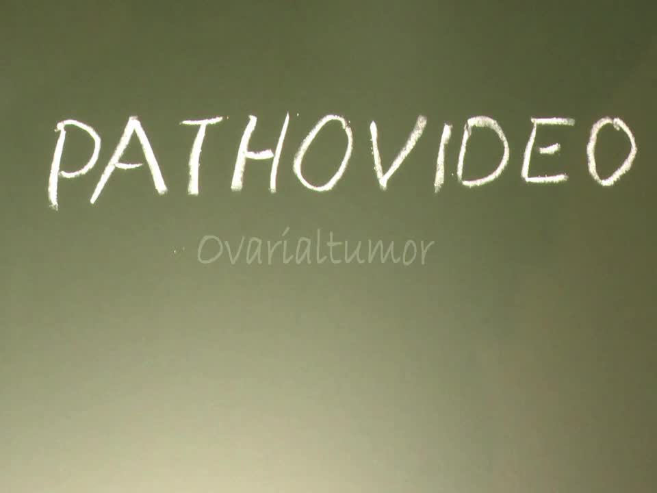 Pathovideo - Ovarialtumor preview image