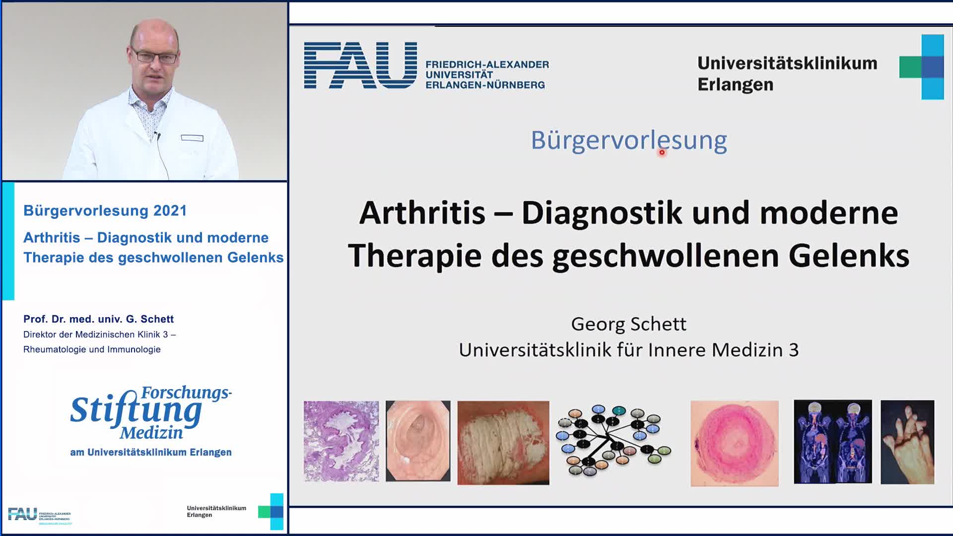 Arthritis - Diagnostik und moderne Therapie des geschwollenen Gelenks preview image