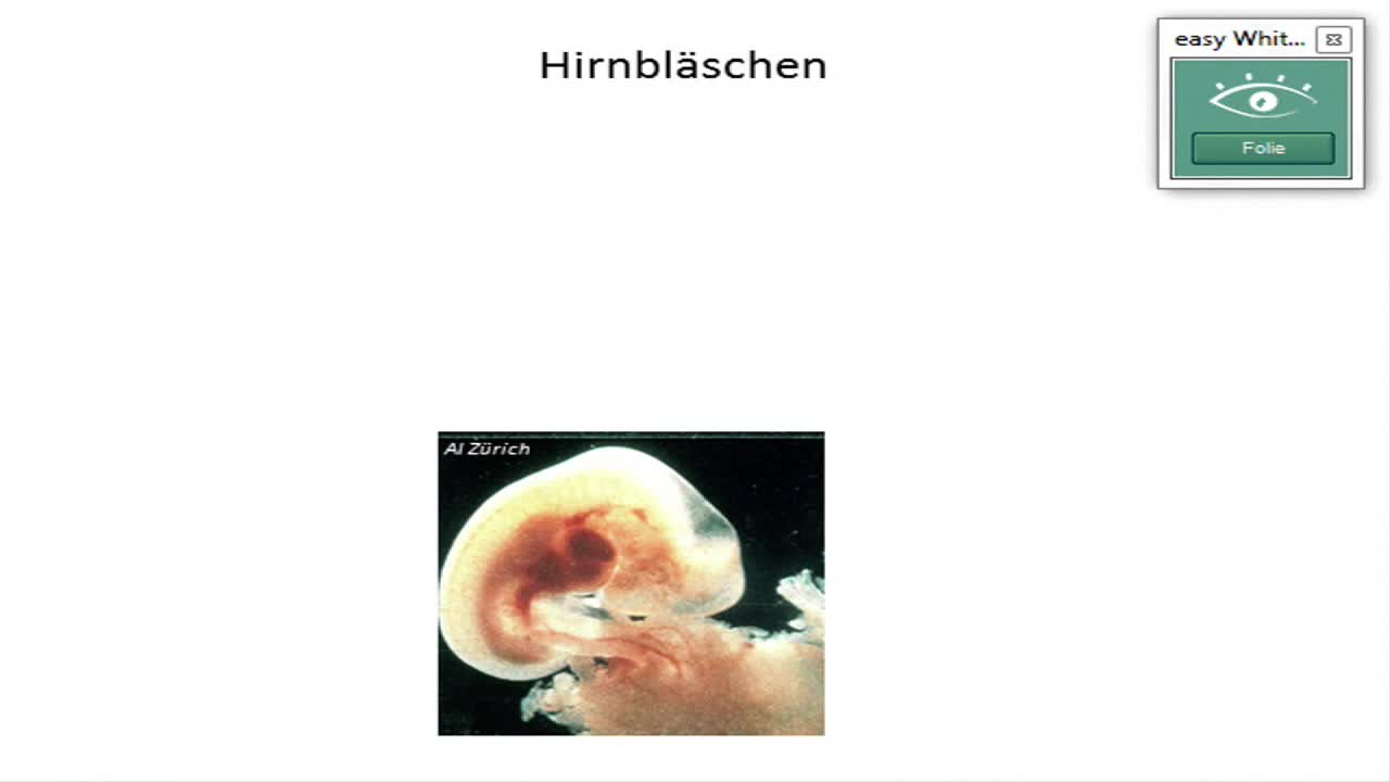 Entwicklung von Hirnstamm, Kleinhirn und Plexus choroideus preview image