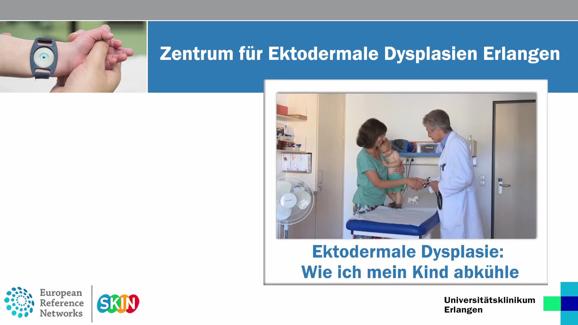 Ektodermale Dysplasie Deutsch preview image