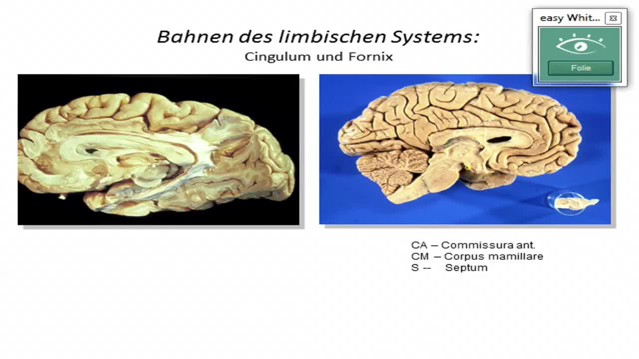 Limbisches System: Amygdala; Hypothalamus makroskopisch preview image