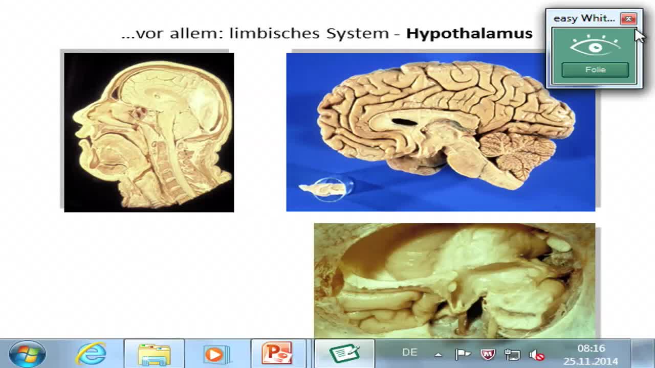 Hypothalamus: zirkumventrikuläre Organe preview image