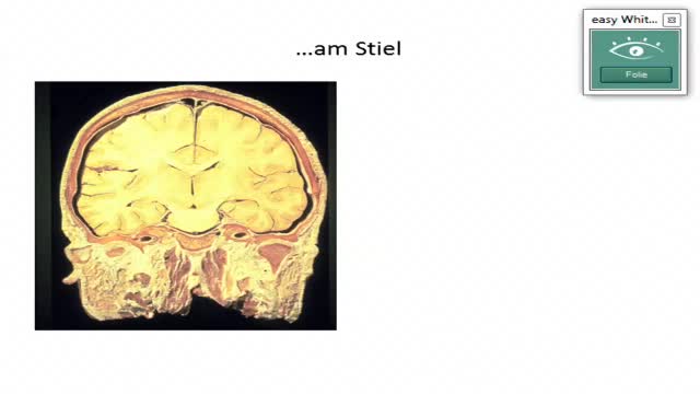 Neuroanatomie: Hirnnerven-Allegorien, Hirnhäute, intrakranielle Blutungen preview image