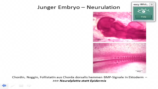 Neuroanatomie: Neurulation, Differenzierung des Neuralrohres preview image
