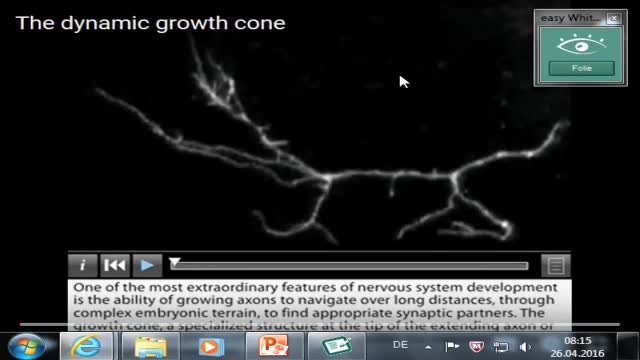 Neuroanatomie: Wachstumskegel, Rückenmarksentwicklung, Neuralleiste preview image