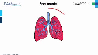 Medcast - Innere Medizin - Pneumonie 1 preview image