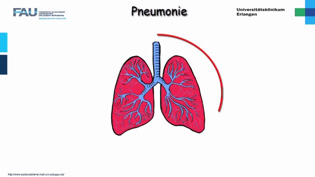 Medcast - Innere Medizin - Pneumonie 2 preview image