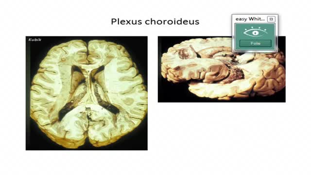 Neuroanatomie: Entwicklung des Prosenzephalons: Rinde, Bahnen, Kerne preview image