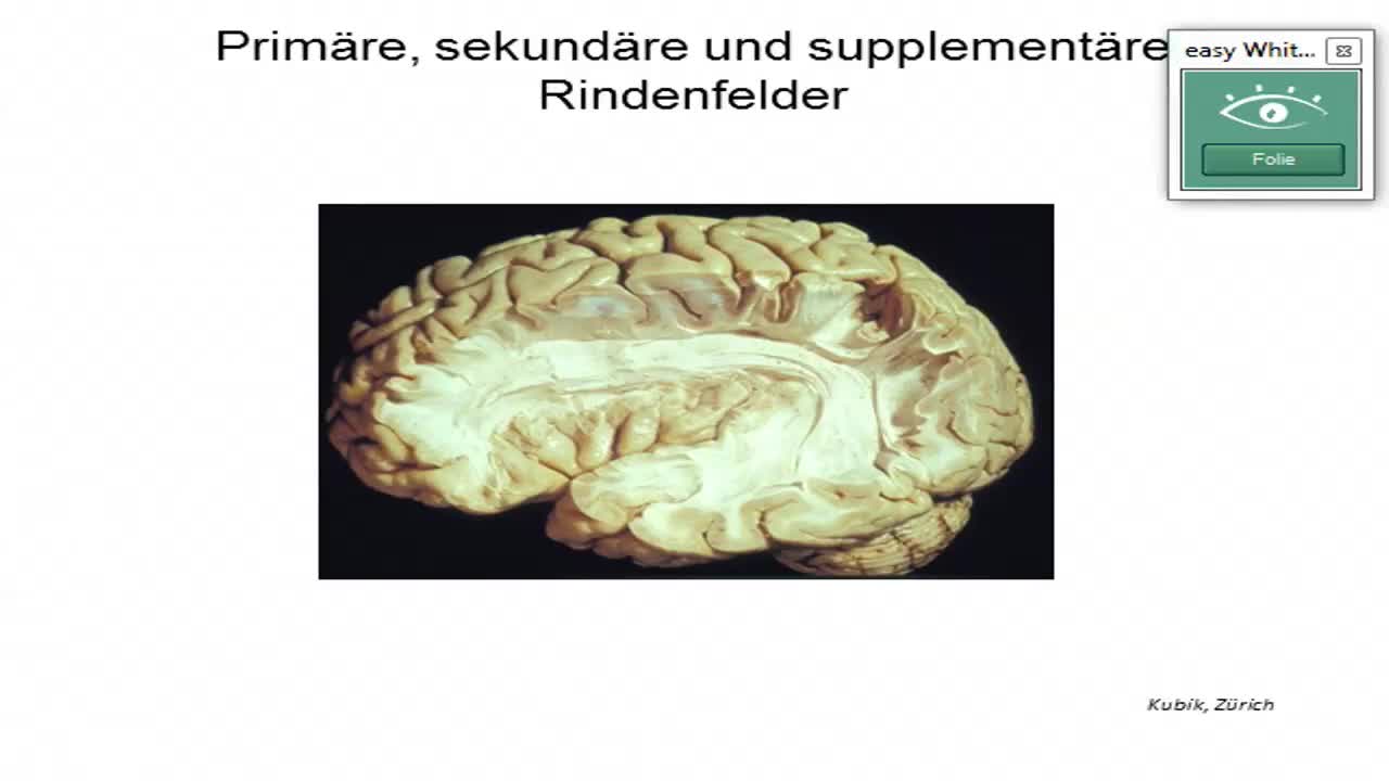 Neuroanatomie: Sprach"zentren", Connectom, ischämischer Insult preview image