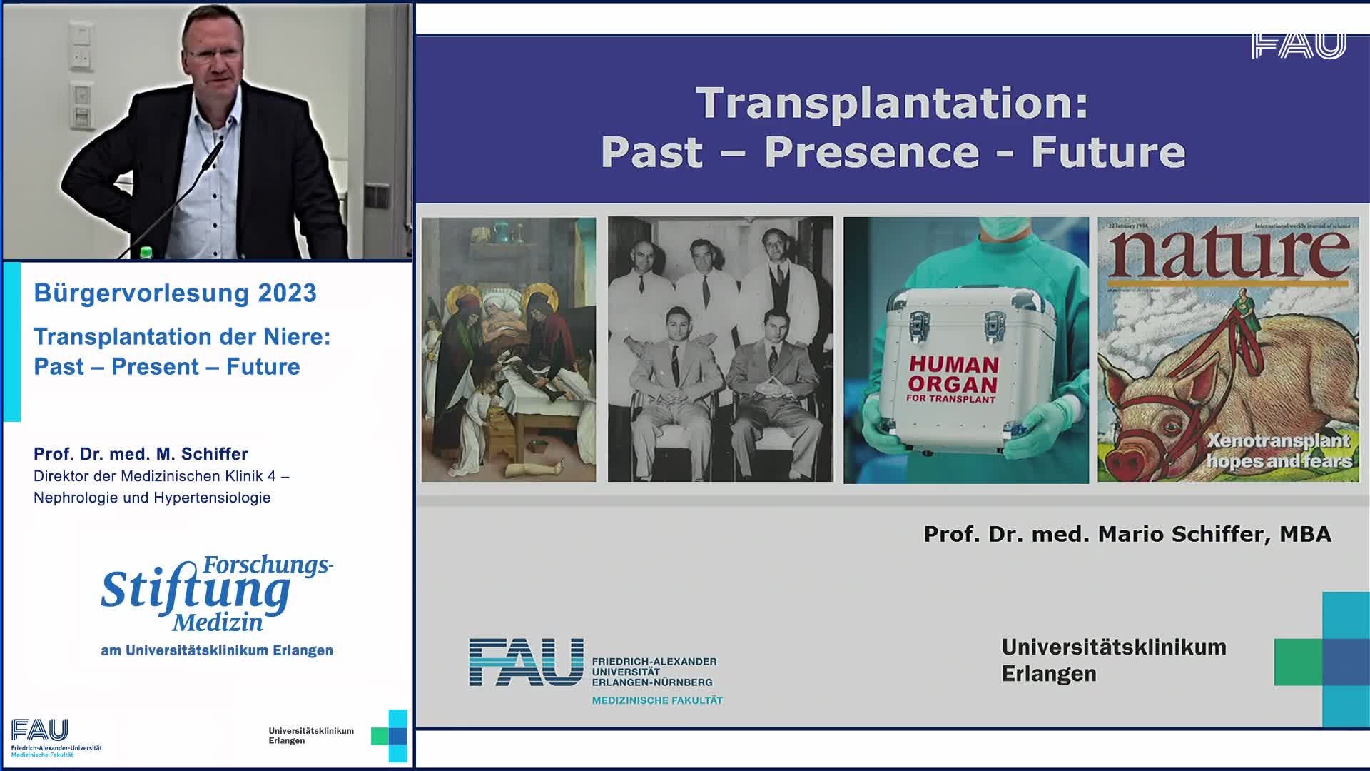Transplantation der Niere: Past – Present – Future preview image