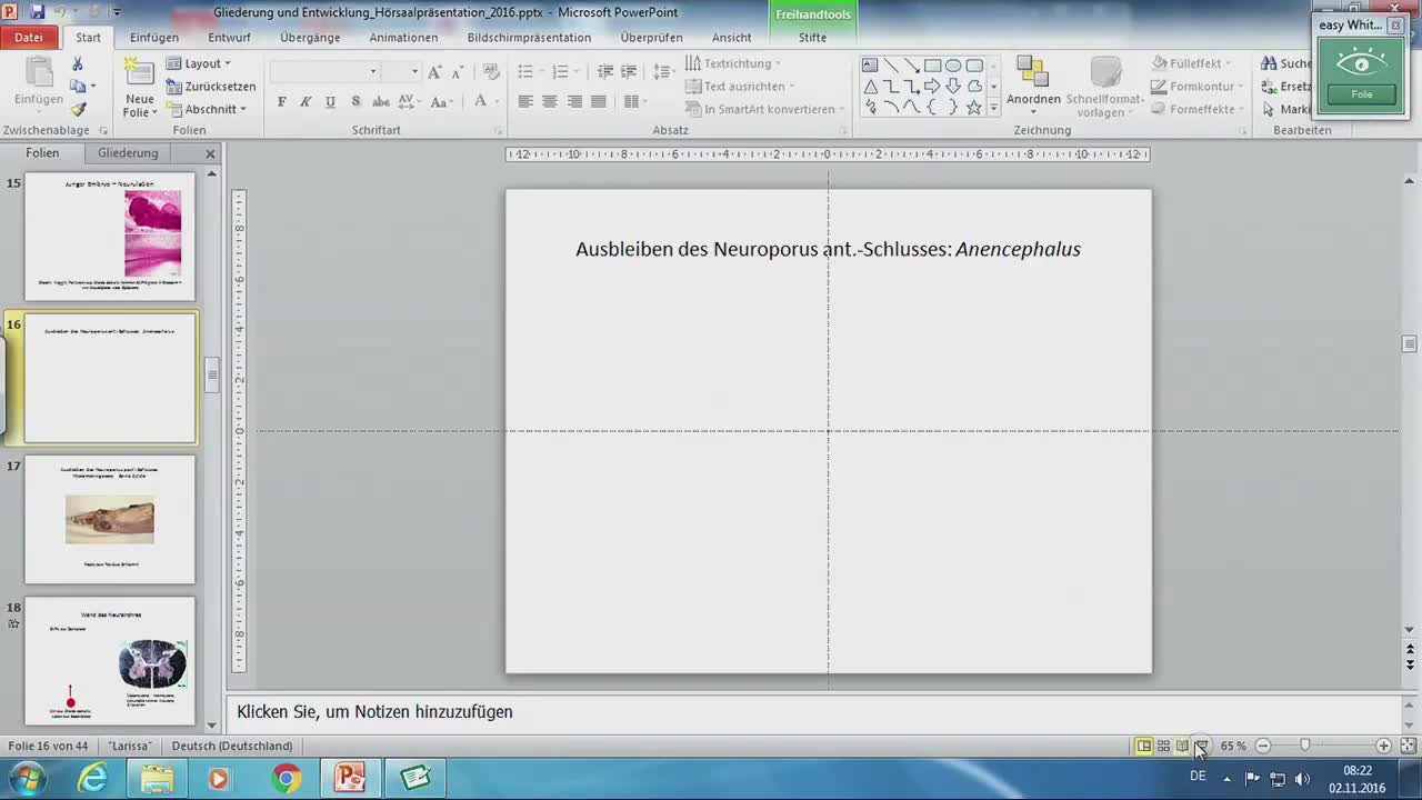 Neuroanatomie - Entwicklung der Rückenmarks, Somatotopik preview image