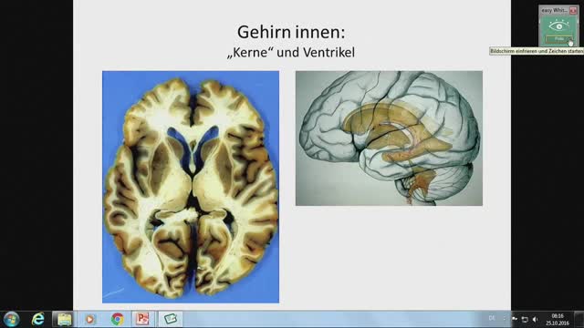 Neuroanatomie - Ventrikel, Plexus choroideus, Blumenkörbchen, Hirnnerven-Einstieg preview image