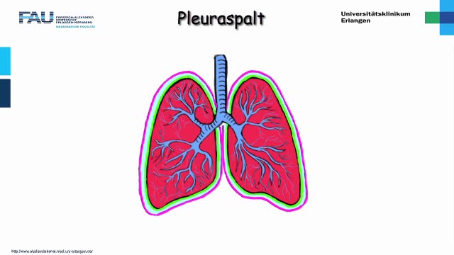 Medcast - Chirurgie - Pleuraspalt 1 preview image
