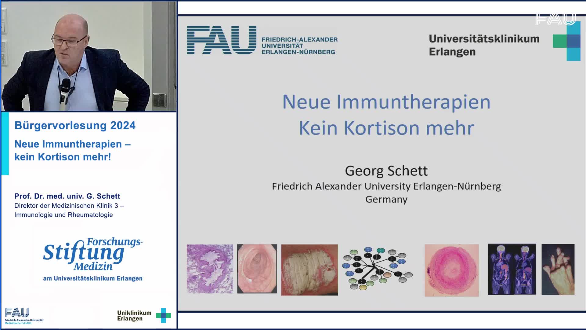 Neue Immuntherapien - kein Kortison mehr! preview image