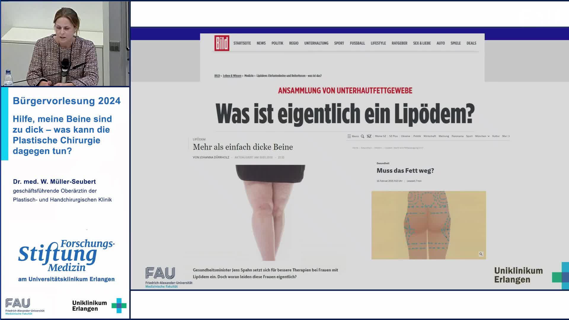 Hilfe, meine Beine sind zu dick – was kann die Plastische Chirurgie dagegen tun? preview image