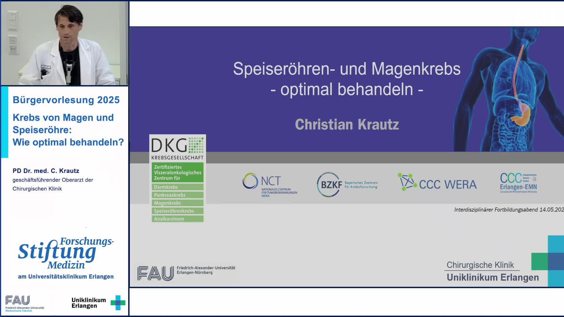 Krebs von Magen und Speiseröhre: Wie optimal behandeln? preview image