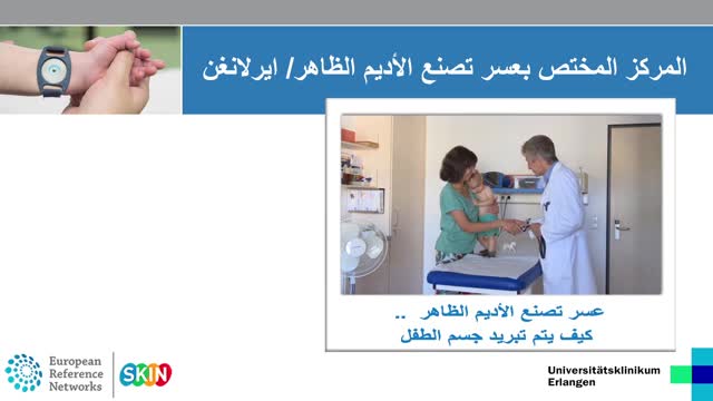Ektodermale Dysplasie Arabisch preview image